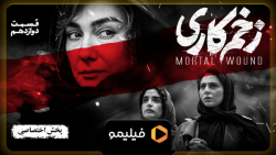 تیزینگ قسمت 12 زخم کاری