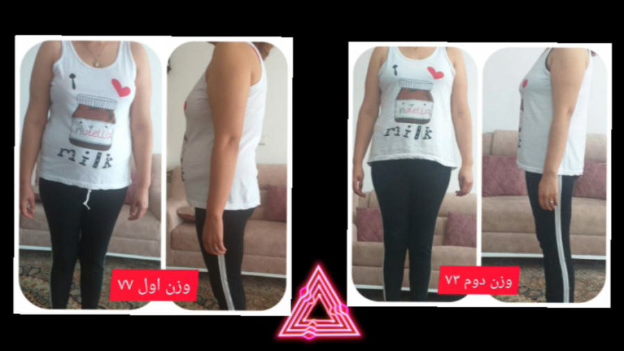 دکترفود | نتیجه رژیم کاهش وزن در کلینیک تخصصی دکترفود درمان جای جوش