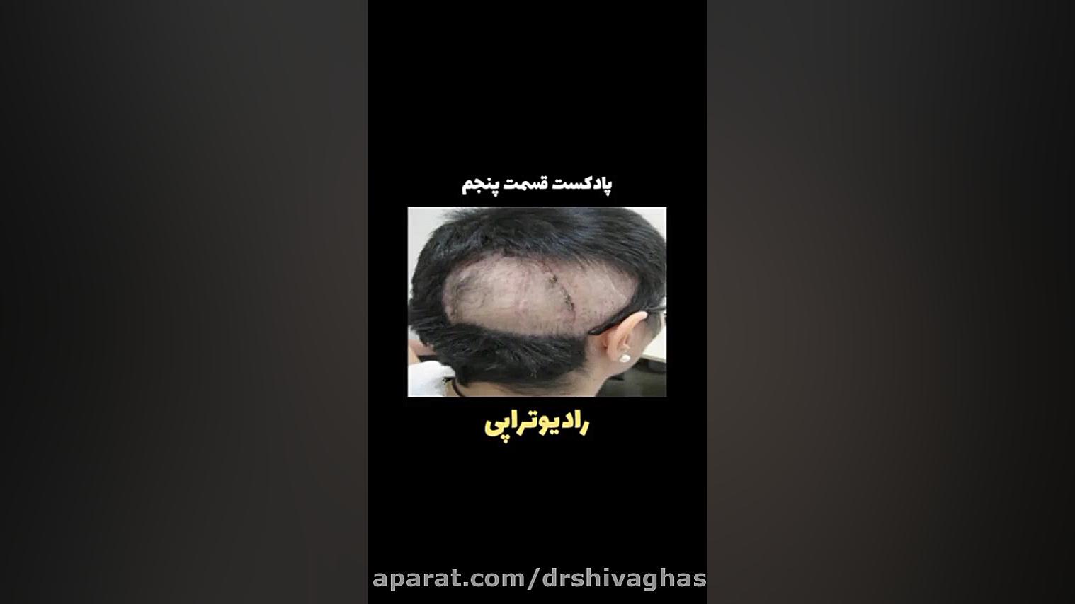 رادیوتراپی (پارت پنجم) دکتر پوست