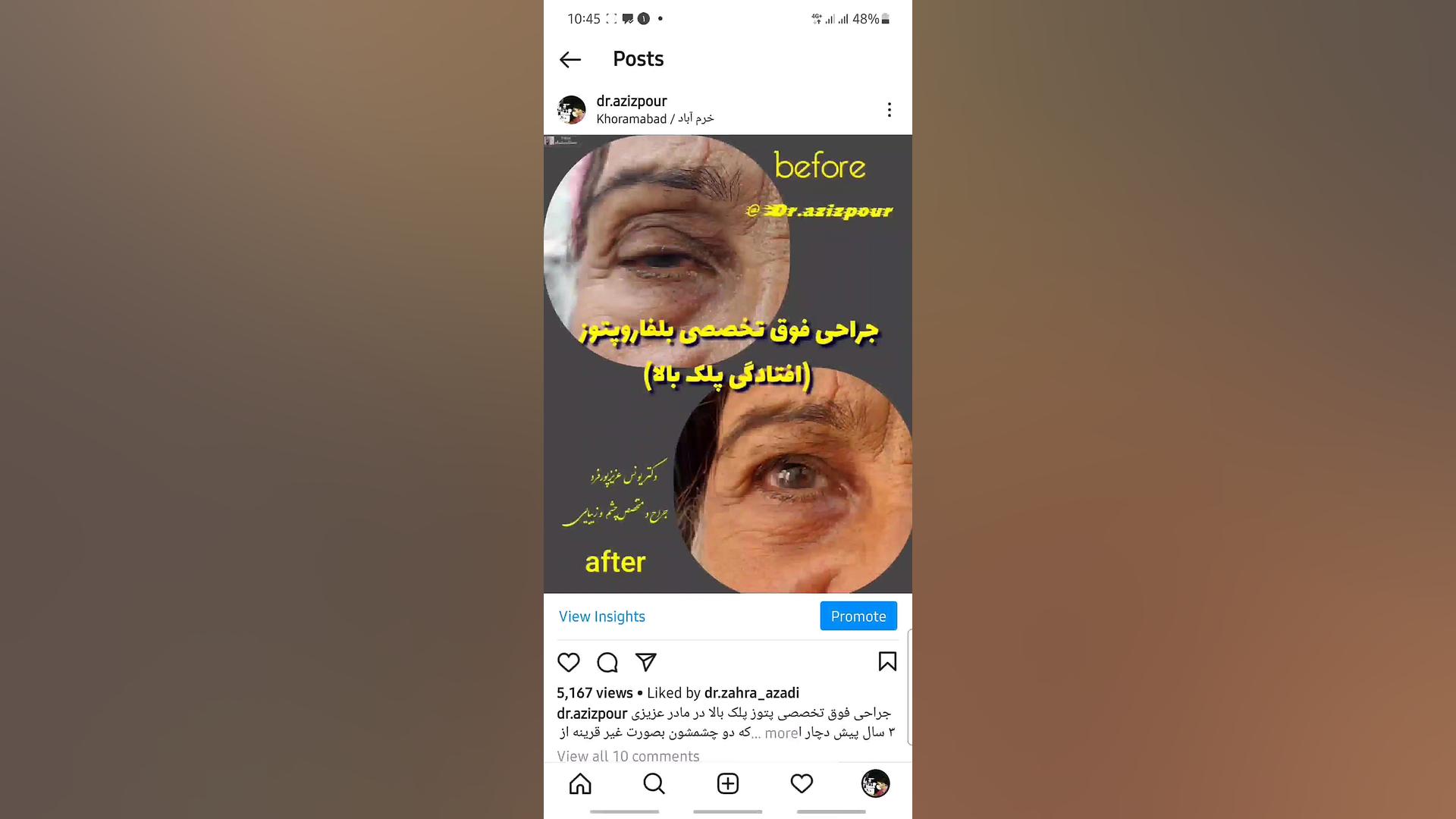 جراحی پتوز پلک افتادگی پلک Organoid Viability Test