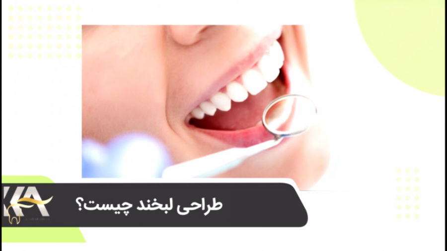 طراحی لبخند چیست؟ دکتر کامیار عباسی