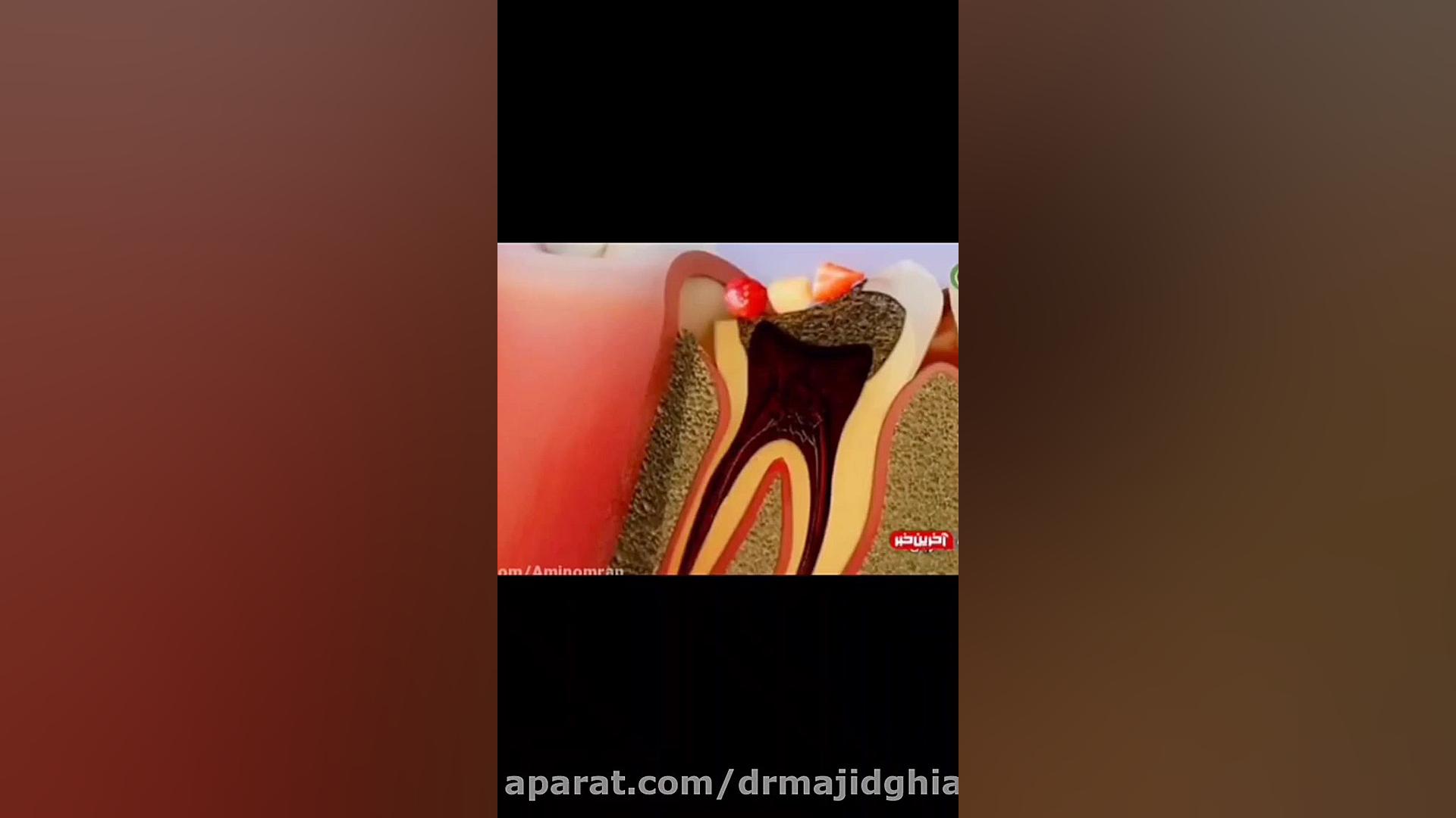 مراقبت از دهان و دندان دکترمجیدقیاسی