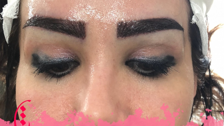 کاشت ابرو بدون جراحی دستگاه بیومتریک پوشیدنی