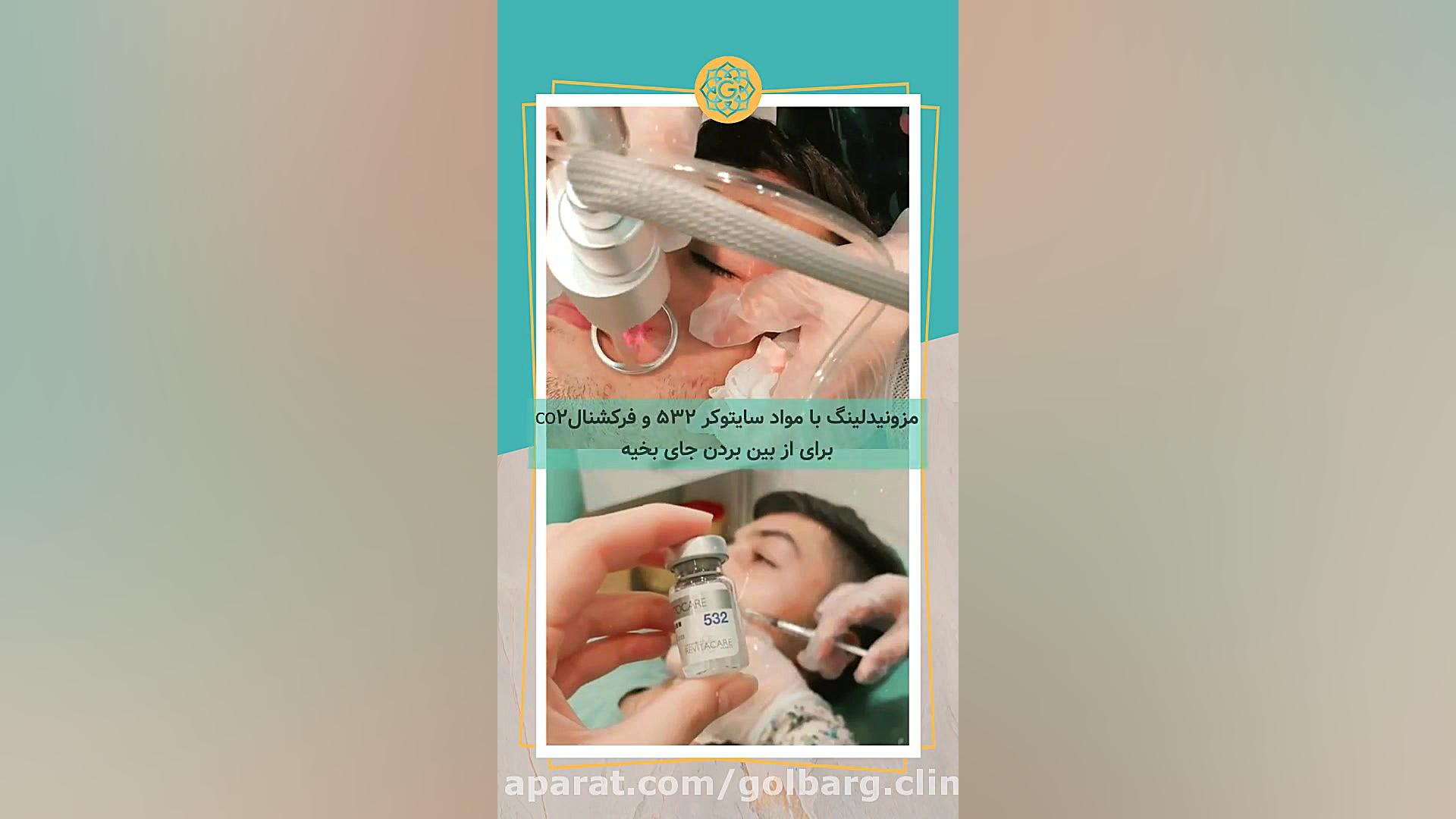 کیلینیک زیبایی پوست و مو گلبرگ رادیوگرافی دندان