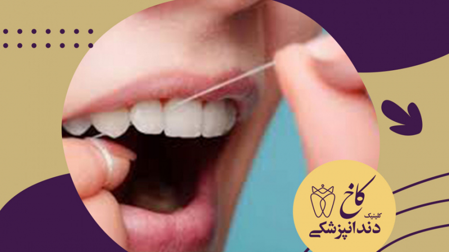 اموزش استفاده از نخ دندان کلینیک دندانپزشکی کاخ