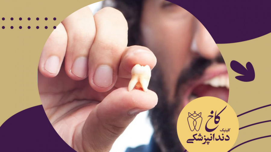 دندان درد بدتر از کرونا کلینیک دندانپزشکی کاخ