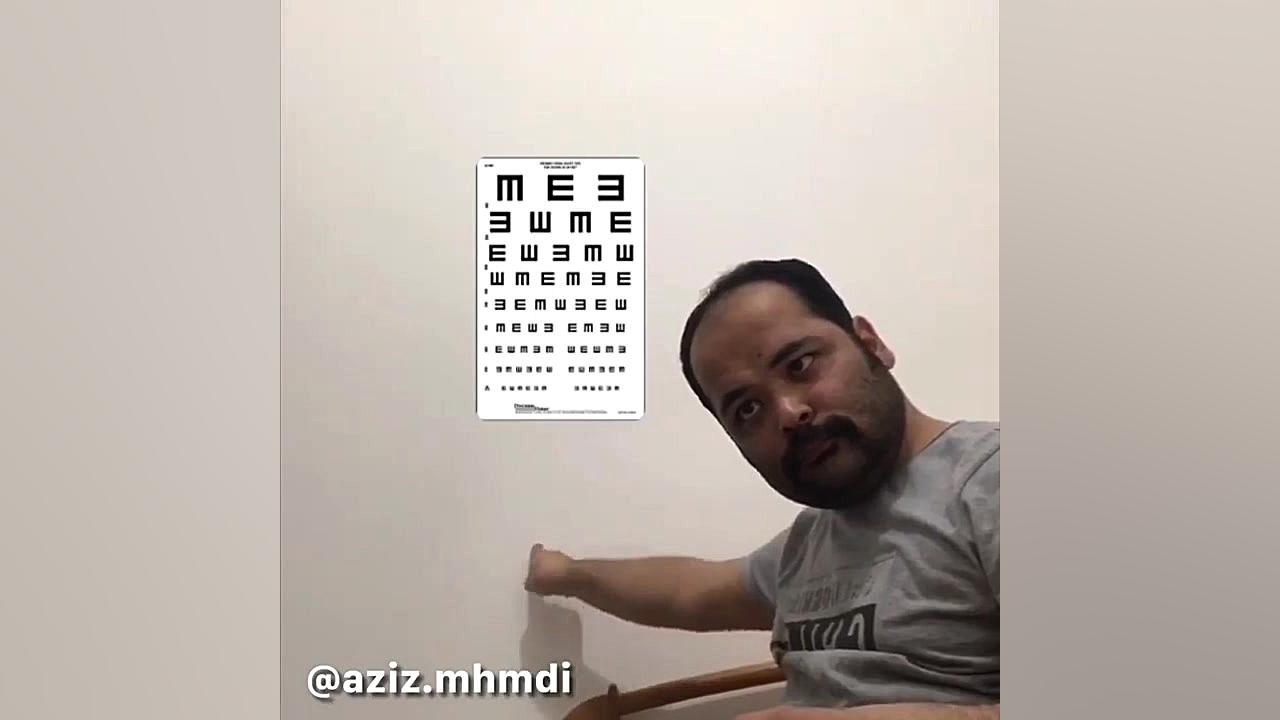 چشم پزشکی عزیز محمدی اصلاح فرم صورت