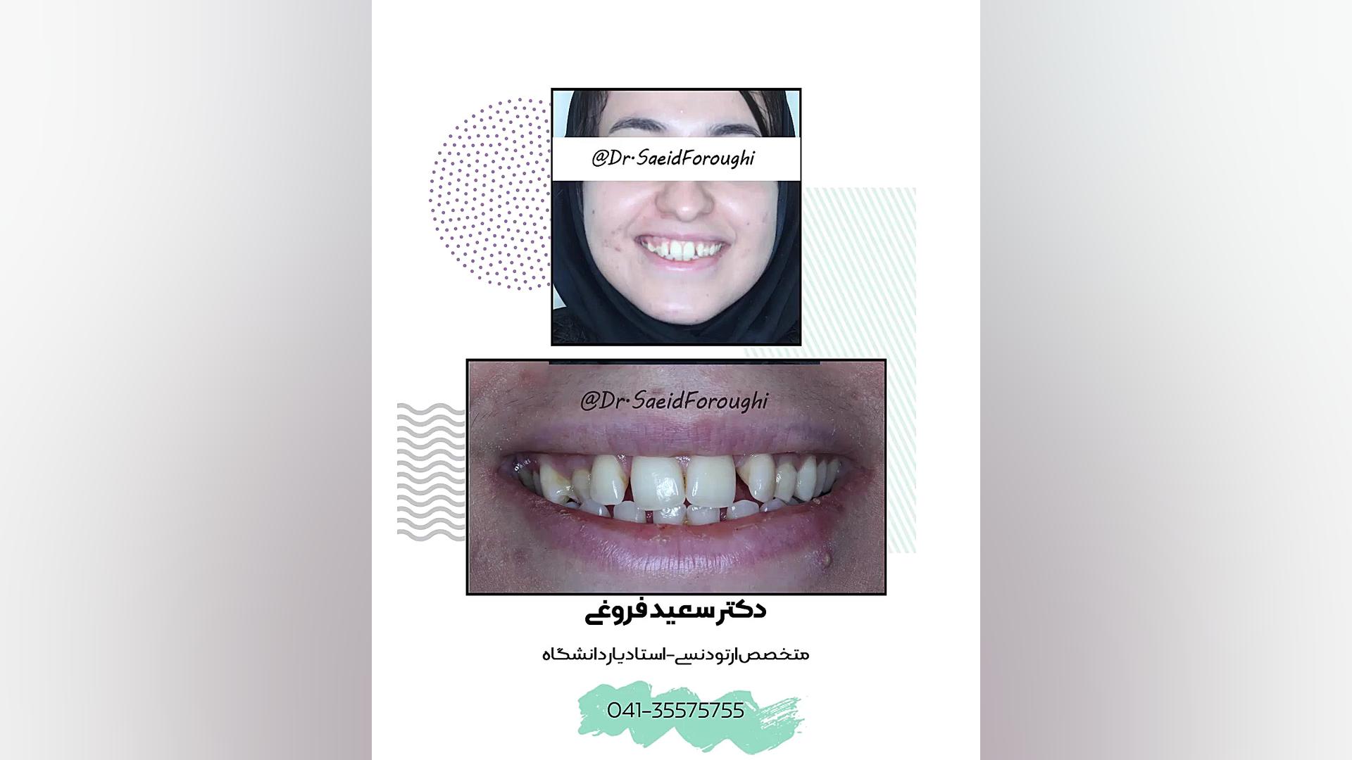 ارتودنسی دندان دکتر سعید فروغی متخصص ارتودنسی