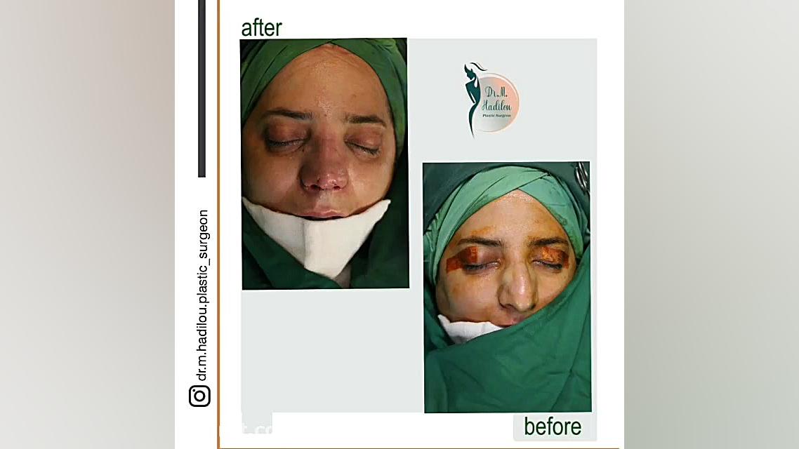 فیلمی کامل و بدون سانسور از اتاق عمل جراحی بینی ترمیم زیبایی دندان