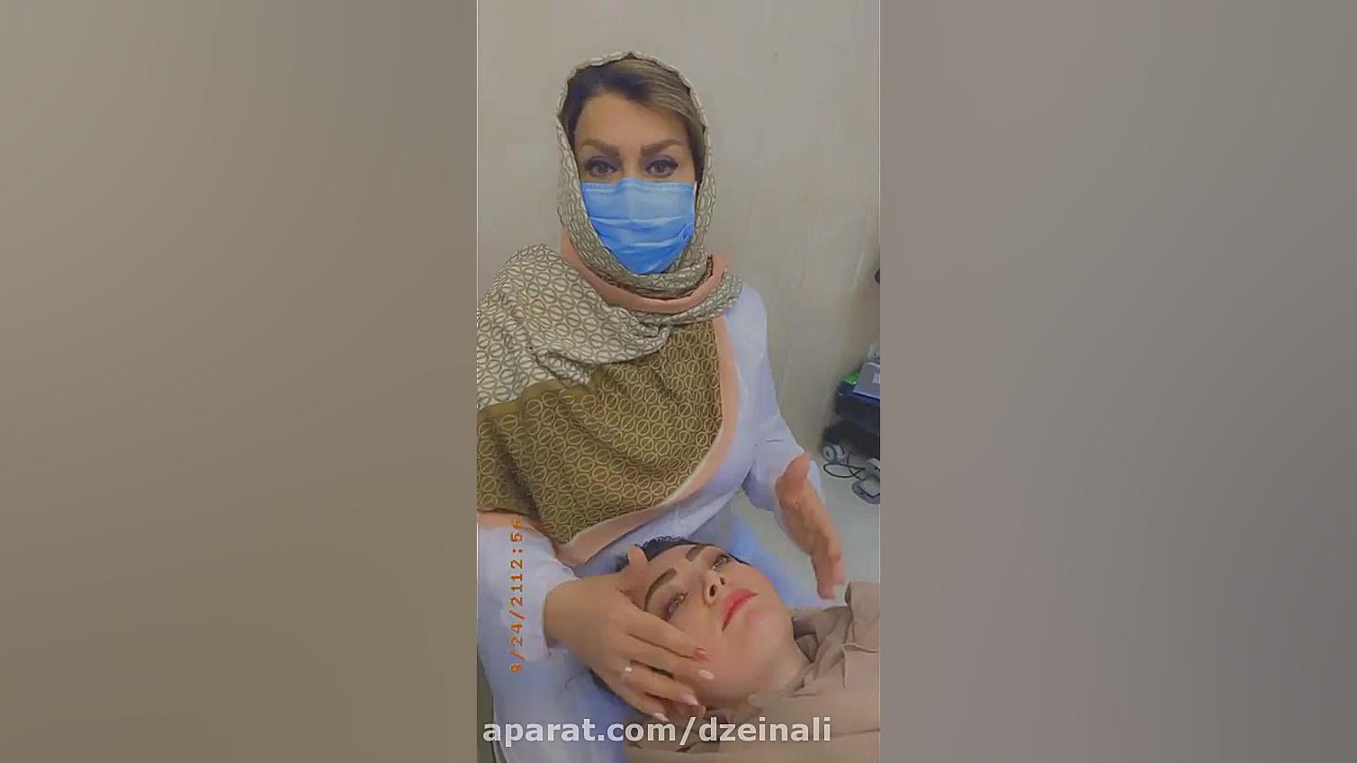 انجام لیزر جوانساز و رفع غبغب اندولیفت برای مراجعه کننده از فرانسه دکتر فرحناز زینعلی - متخصص پوست، مو، زیبایی زنجان