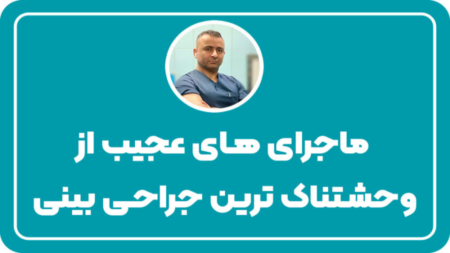 ماجرای های عجیب از وحشتناک ترین جراحی بینی مگالودکس