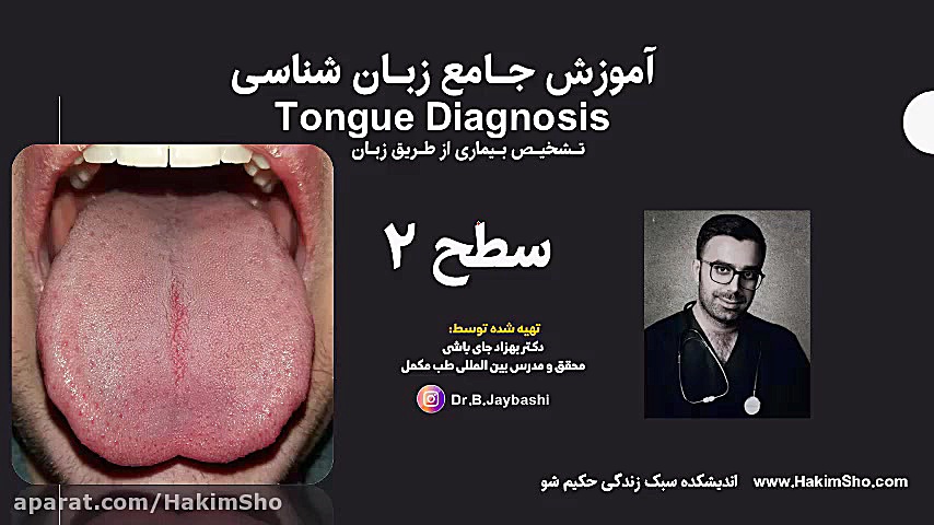 تشخیص بیماری از طریق زبان پزشکی هیپر باریک