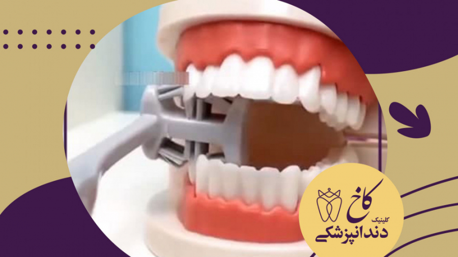 مسواکی جالب برای پاک کردن تمام سطوح دندان کلینیک دندانپزشکی کاخ