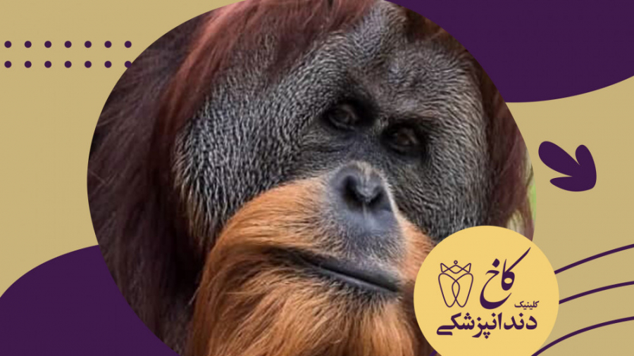 تا مرد سخن نگفته باشد عیب و هنرش نهفته باشد کلینیک دندانپزشکی کاخ