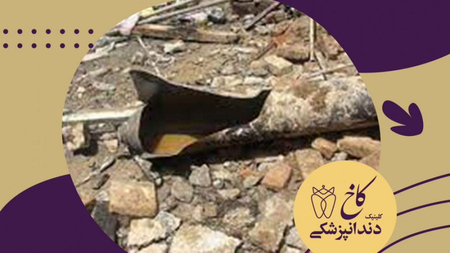 انفجار کپسول اکسیژن با دست چرب کلینیک دندانپزشکی کاخ