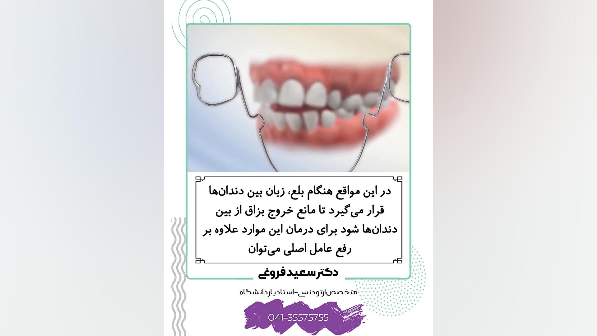 ارتودنسی دندان دکتر سعید فروغی متخصص ارتودنسی