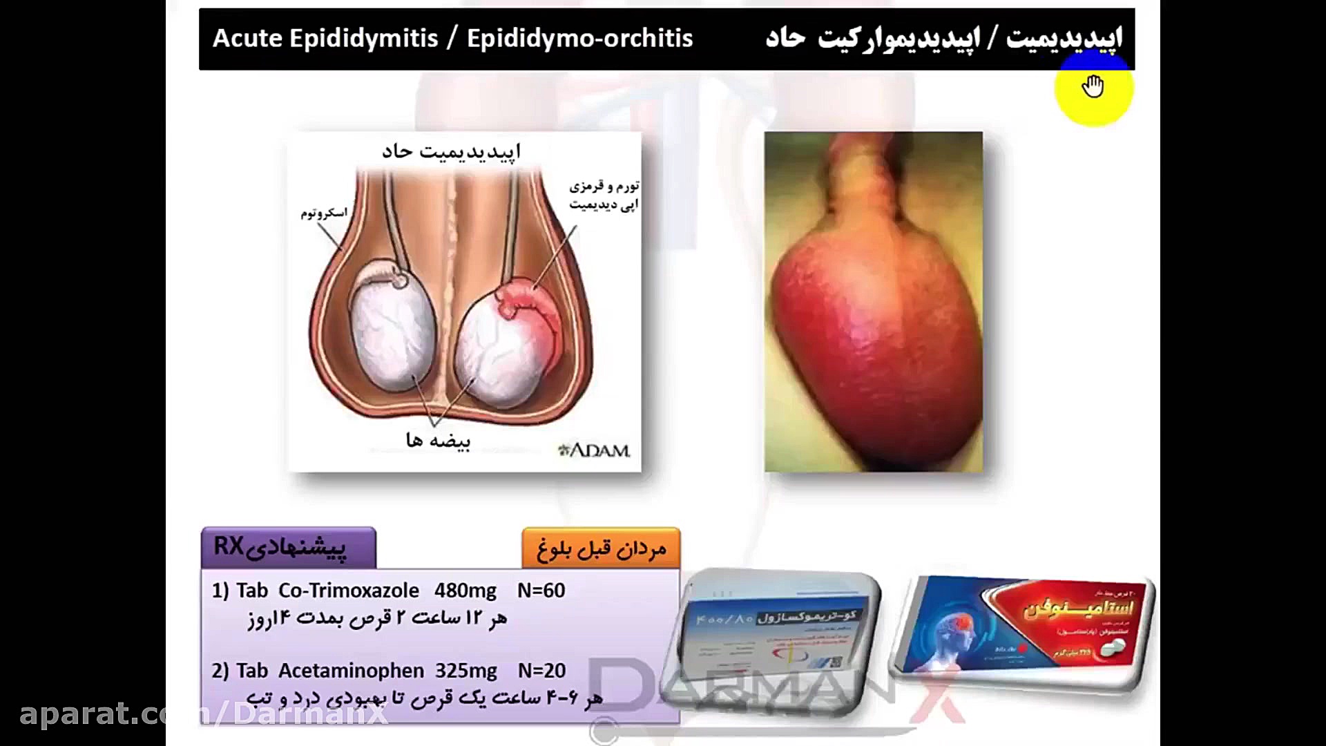 آموزش ارولوژی(نسخه، اوردر، اپروچ، آزمایشات و...)(اپیدیدیمیت) درمان ریزش مو