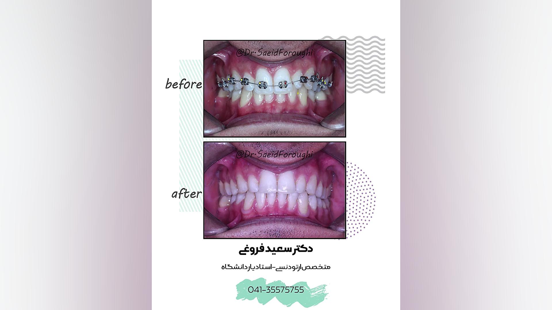 ارتودنسی دندان دکتر سعید فروغی متخصص ارتودنسی