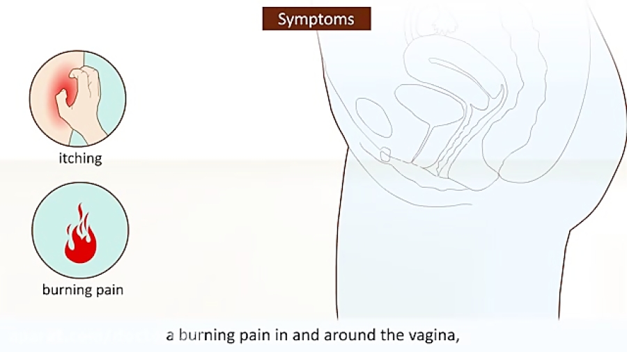 بهداشت بانوان