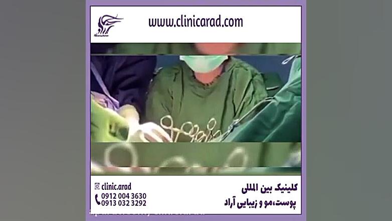 اشکال مختلف پرده بکارت و عمل زیبایی دندانپزشک زیبایی