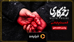 تیزینگ قسمت پایانی زخم کاری