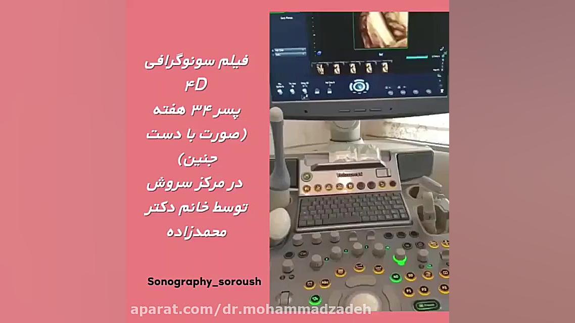سونوگرافی چهار بعدی جنین 34 هفته ای عمل زیبایی