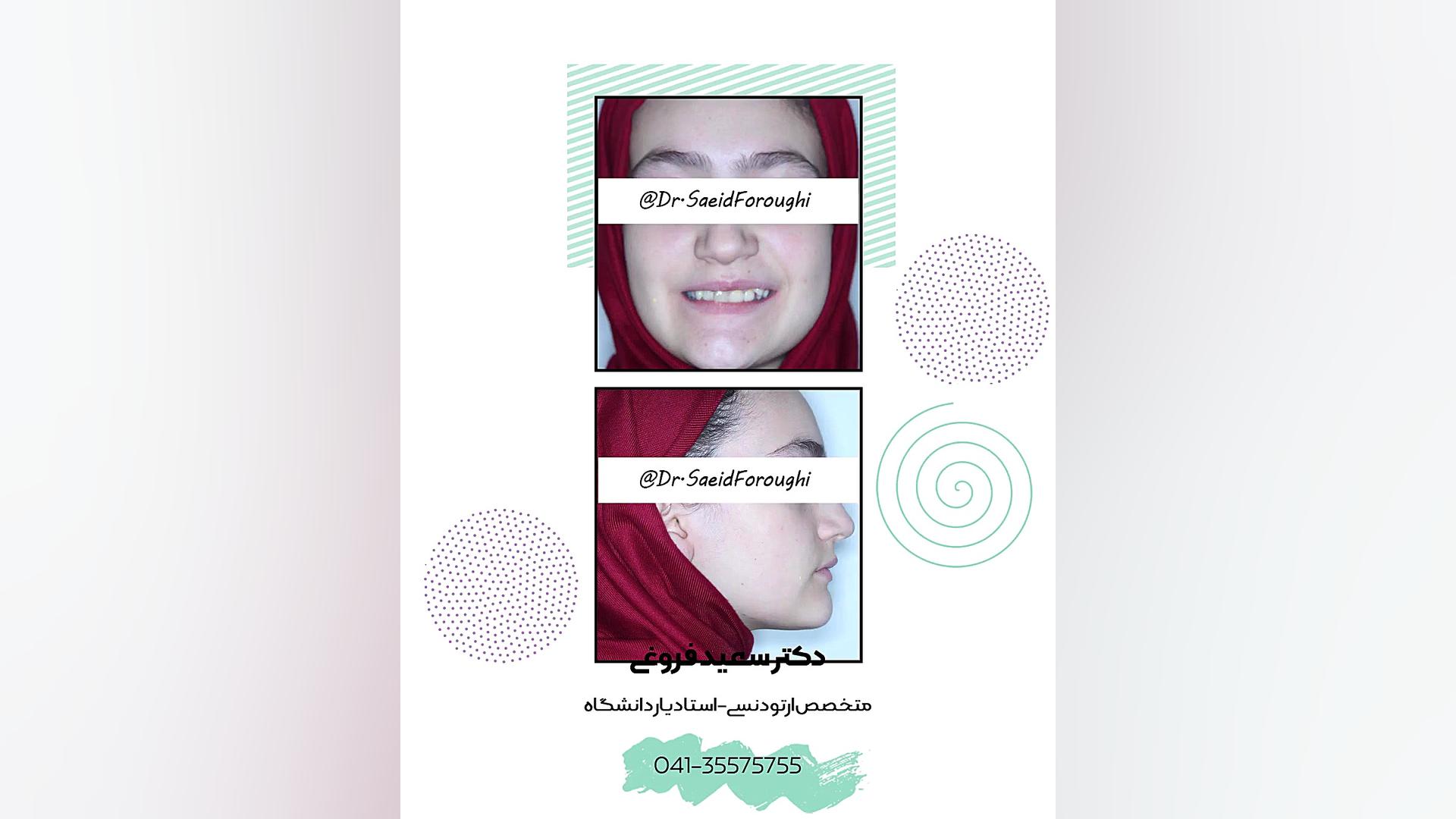 ارتودنسی دندان دکتر سعید فروغی متخصص ارتودنسی