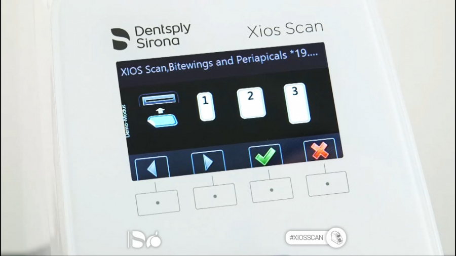 نکات استفاده از فسفرپلیت Xios Scan محصول کمپانی Dentsply Sirona دیسمورفی فاسیال