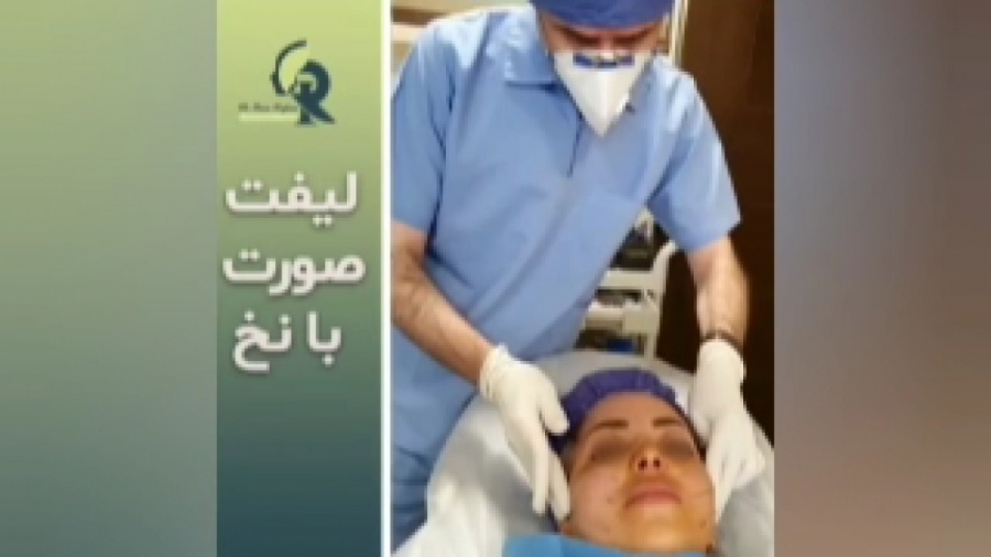 لیفت صورت با نخ بیماری سندروم نوتان