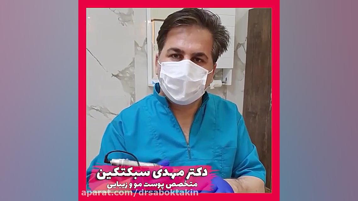 میکرونیدلینگ توسط دکتر سبکتکین متخصص پوست اصفهان متخصص پوست اصفهان دکتر مهدی سبکتکین