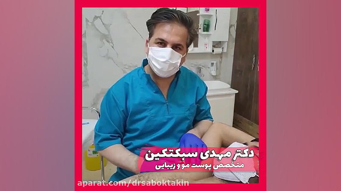 تزریق بوتاکس زیر بغل جهت کاهش تعریق متخصص پوست اصفهان دکتر مهدی سبکتکین