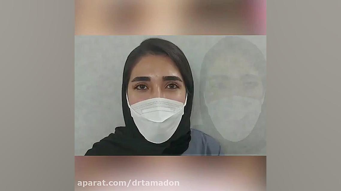 جراحی بلفاروپلاستی پلک بالا روکش دندان