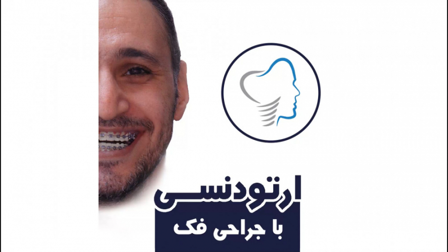 ارتودنسی جلو بودن فک پایین با جراحی | دکتر داودیان بیماری مایکلیناپاتی