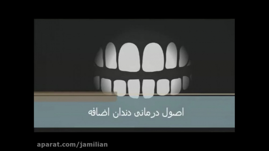 درمان دندان اضافه و ارتودنسی / متخصص ارتودنسی / دکتر جمیلیان دکتر عبدالرضا جمیلیان - متخصص ارتودنسی