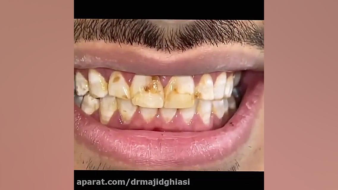 اصلاح طرح لبخند دکترمجیدقیاسی