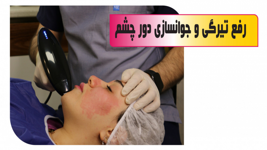 آراف فرکشنال ترمیا تری‌متازیدین