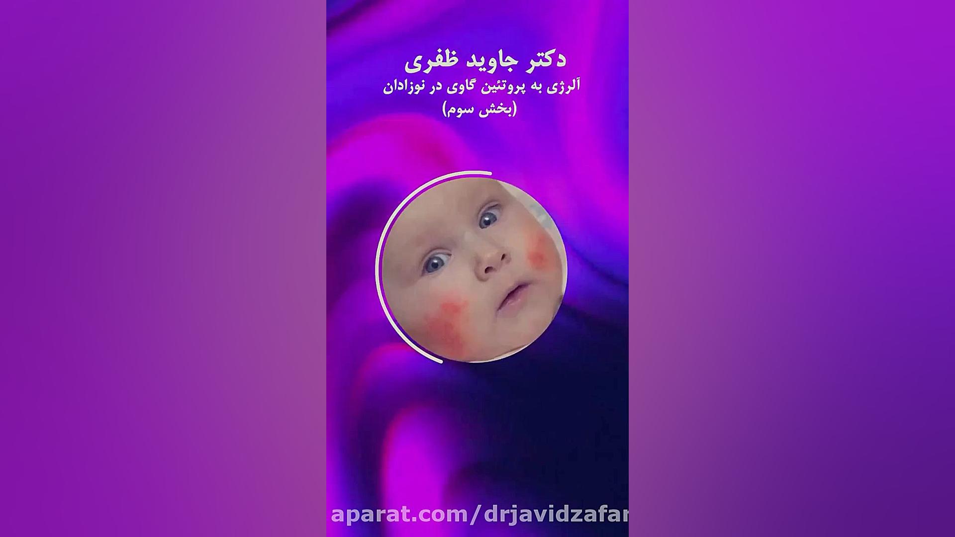آلرژی به پروتئین گاوی در نوزادان چگونه درمانی می شود؟ لیپوست