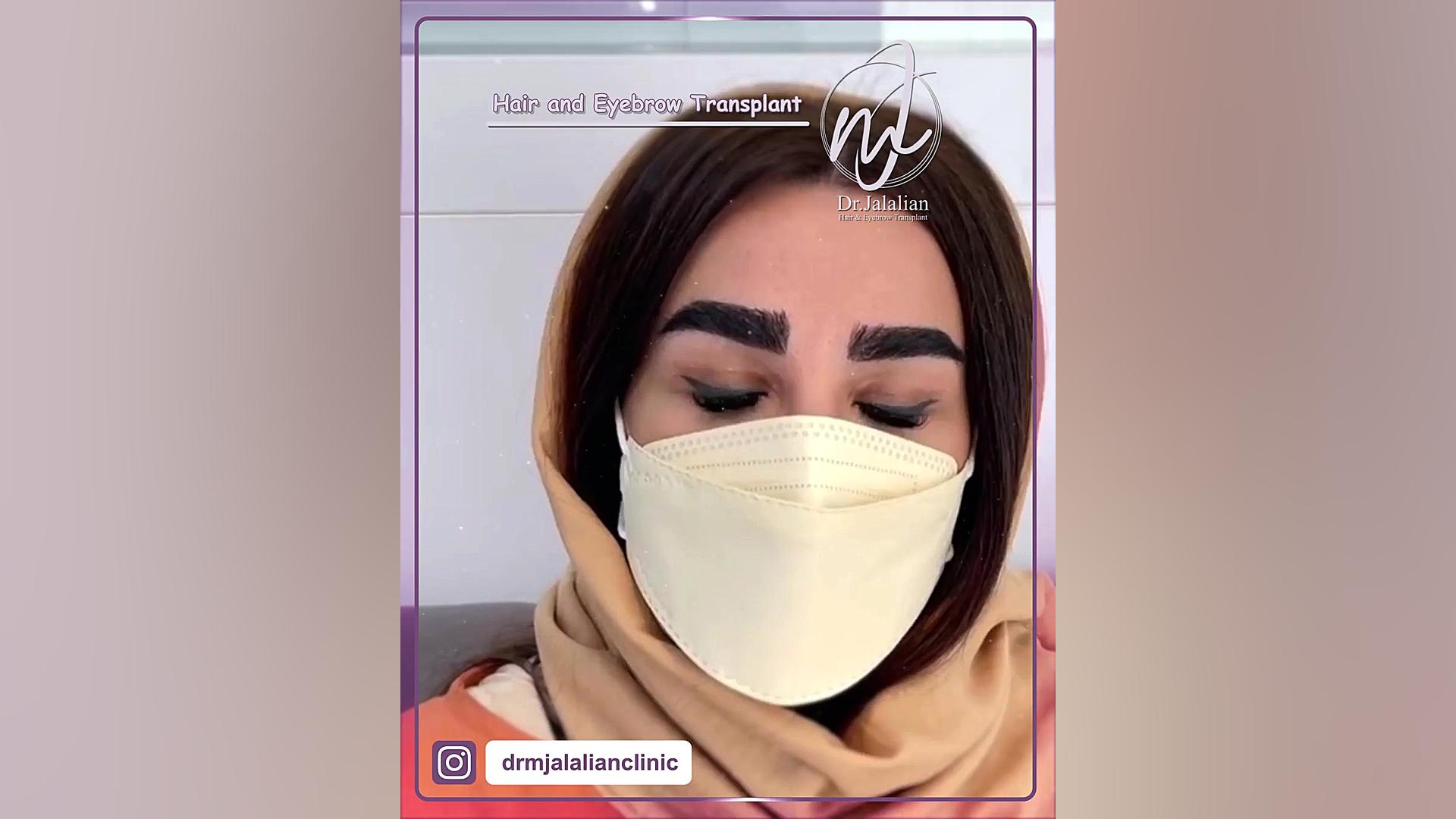 رضایت مشتریان - کلینیک زیبایی دکتر جلالیان روکش دندان