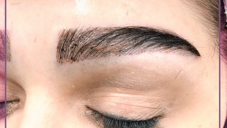 نمونه کار == کلینیک زیبایی دکتر جلالیان آکنه