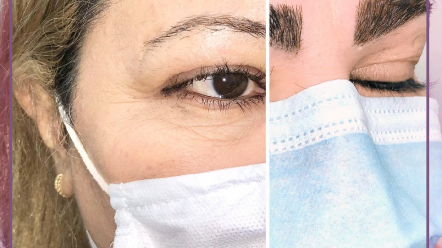 نمونه کار == کلینیک زیبایی دکتر جلالیان ایم‌دولیموماب