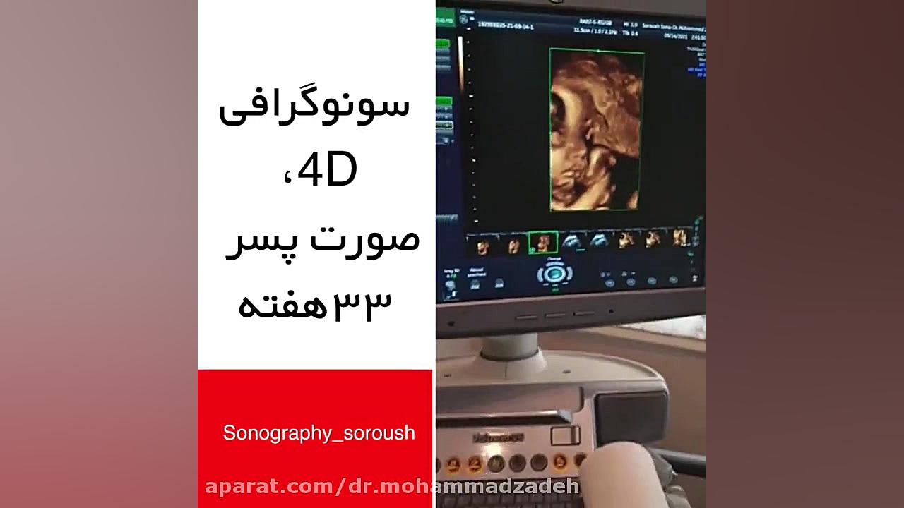 فیلم سونوگرافی 4d تنبان گشاد