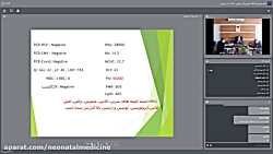 یک نوزاد با شلی و اشکال در تغذیه