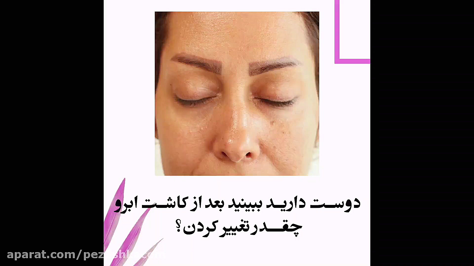 کاشت ابرو در کلینیک آوینا آزمون آنتی‌بادی خنثی‌کننده
