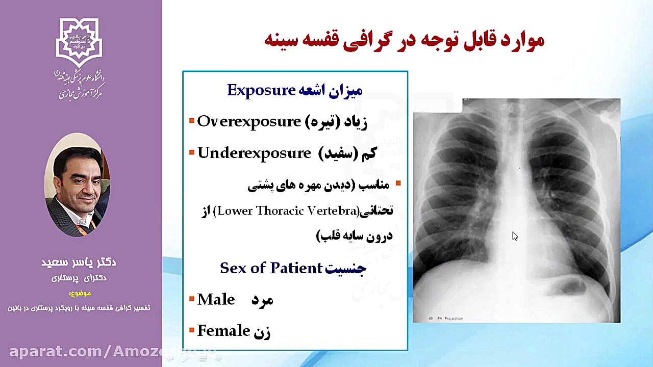 تفسیرگرافی قفسه سینه با رویکرد پرستاری در بالین تزریق بوتاکس