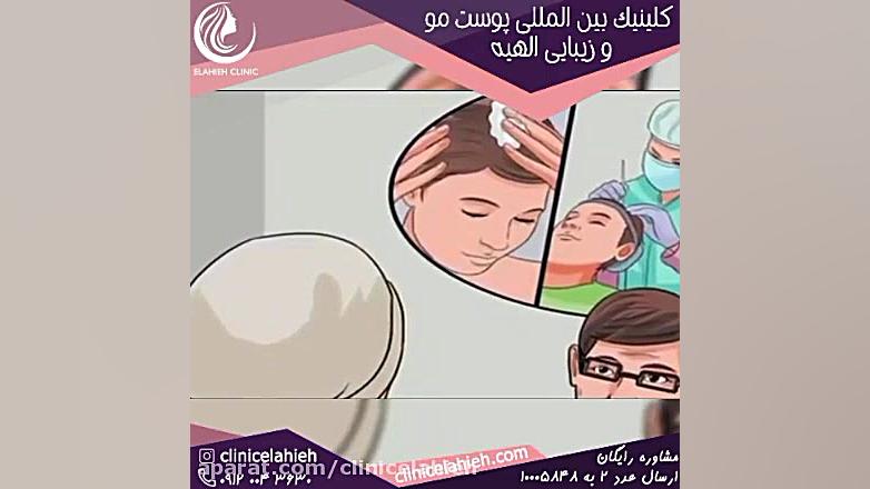 قرص اسپیرونولاکتون و درمان ریزش مو در کلینیک الهیه Anti-CCP