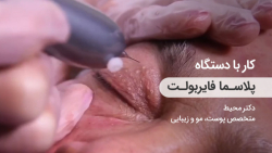 بلفاروپلاستی، رفع خال و ضایعات پوستی توسط فایربولت - خانم دکتر محیط بلفاروپلاستی، رفع خال و ضایعات پوستی توسط فایربولت - خانم دکتر محیط