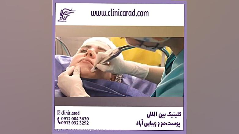 بهترین دکتر پوست و مو در تبریز پزشکی کوهستان