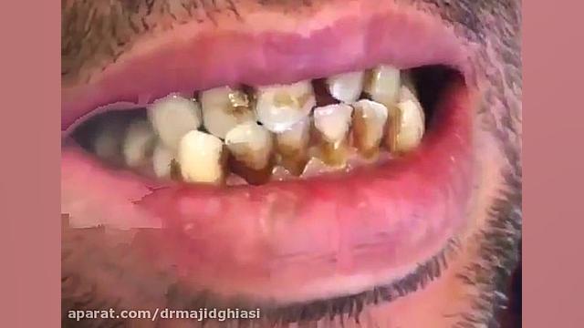 اصلاح طرح لبخند دکترمجیدقیاسی