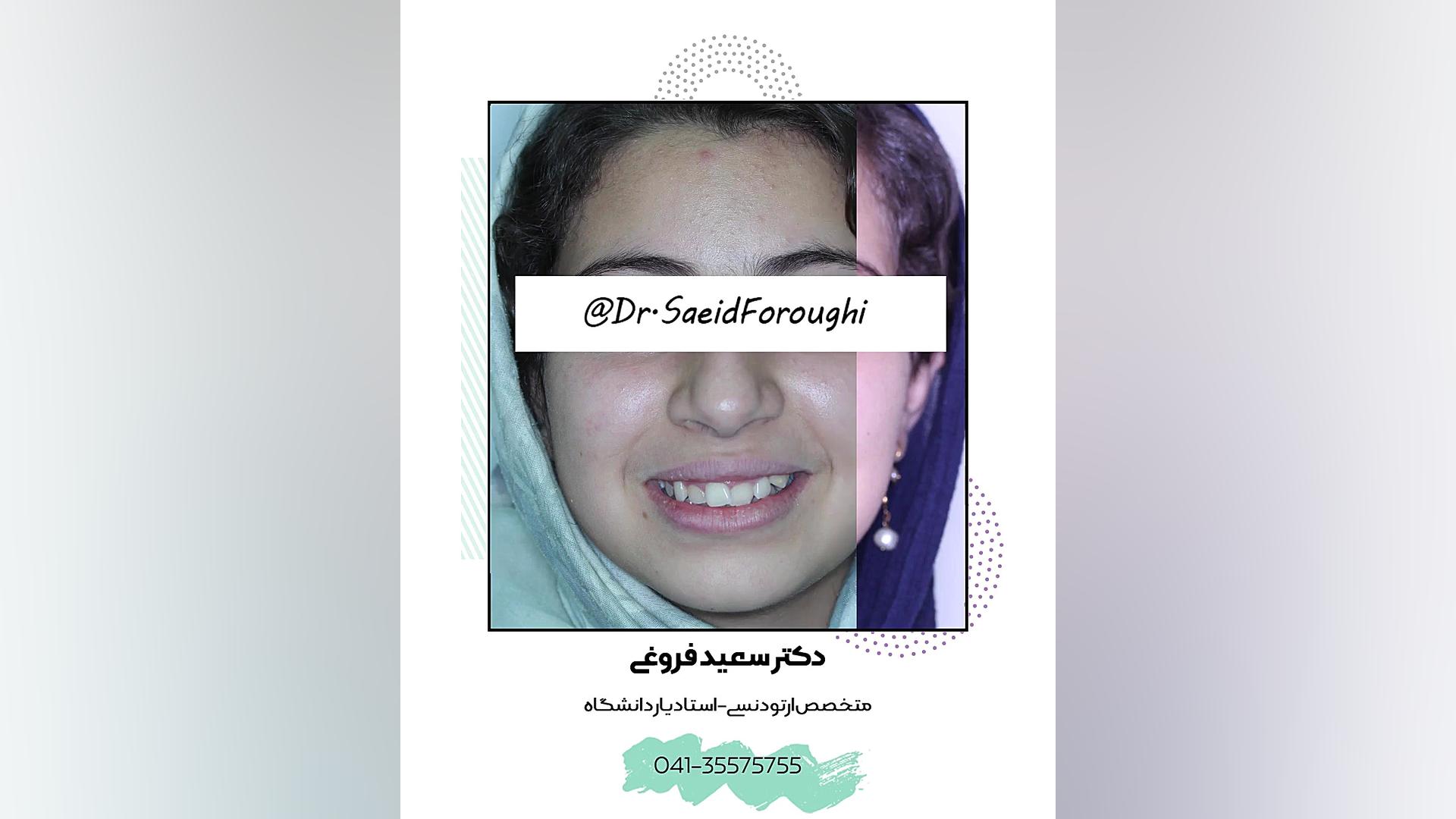 ارتودنسی دندان دکتر سعید فروغی متخصص ارتودنسی