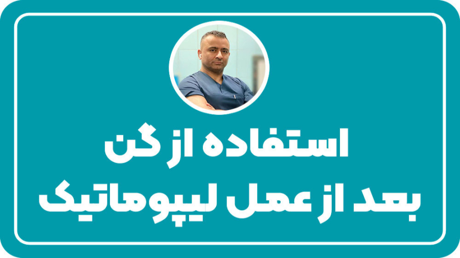 استفاده از گن بعد از عمل لیپوماتیک| دکتر کامبیز ایزدپناه دستگاه فیبر نوری جراحی